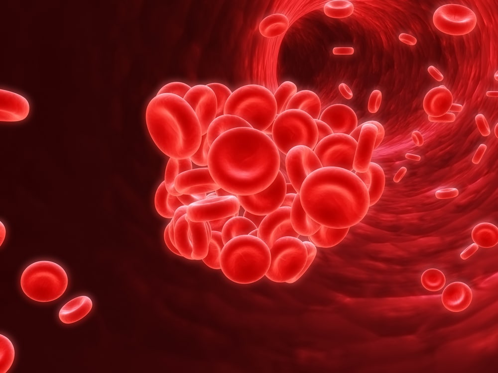 Everything you Need to Know About Traveling Blood Clots Health and