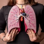 5 Signs You Could Have Lung Cancer