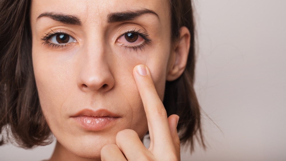 Struggling With Dry Eye? Are You Making It Worse? Health and Wellness