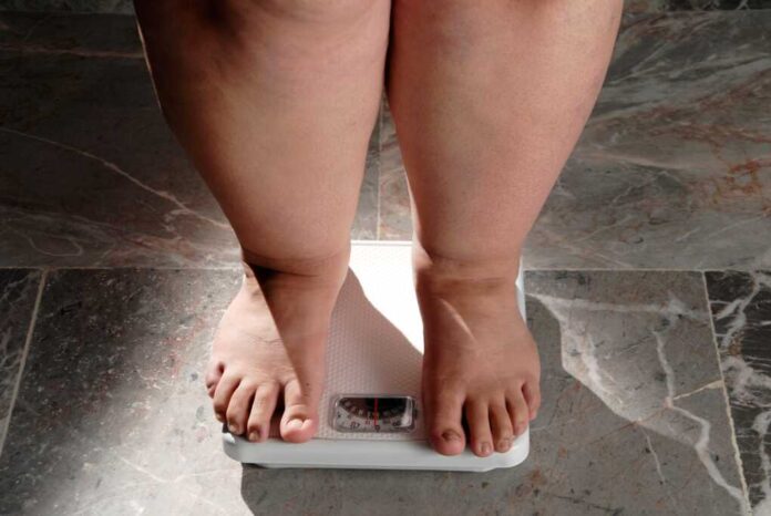 Obesity,And,Overweight,,Overweight,Woman,Feet,On,The,Scale,,Concept