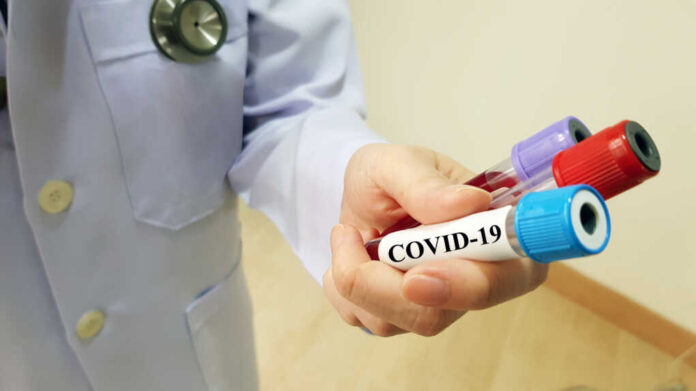 Covid,19,Test,And,Laboratory,Sample,For,Diagnosis,And,Screening
