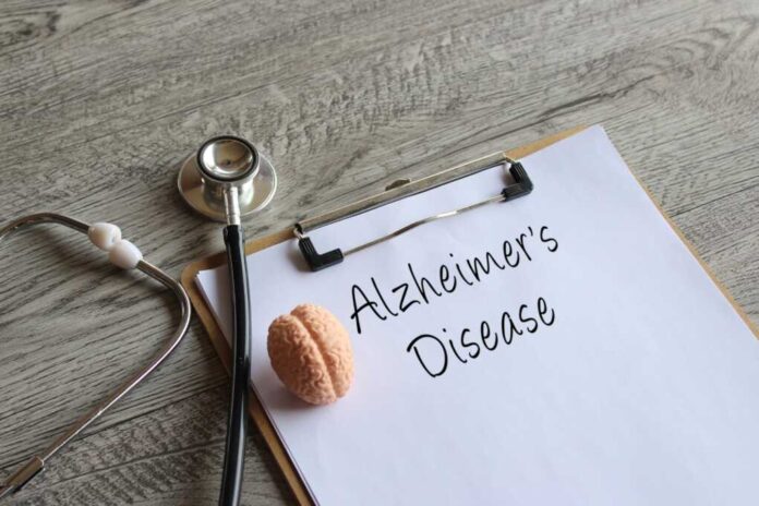 Stethoscope,,Human,Brain,Model,And,Paper,Clipboard,With,Text,Alzheimer's