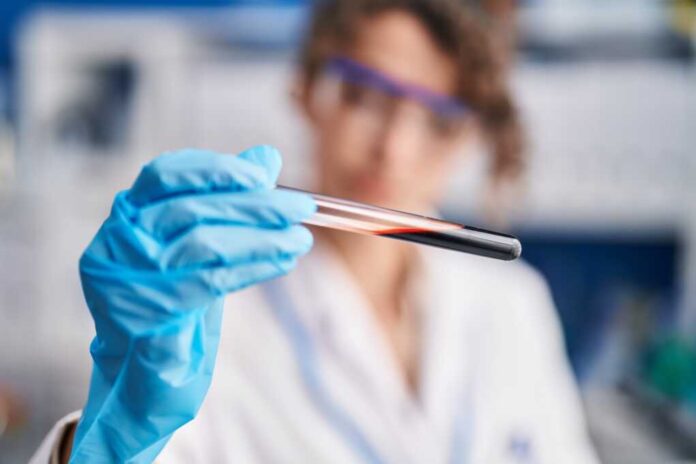 Young,Hispanic,Woman,Scientist,Holding,Blood,Test,Tube,Analysis,At