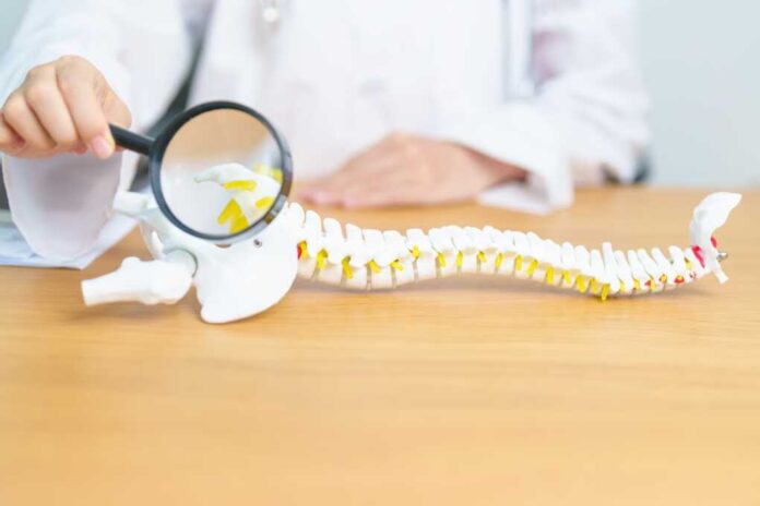 Doctor,With,Human,Spine,Anatomy,Model.,Spinal,Cord,Disorder,And