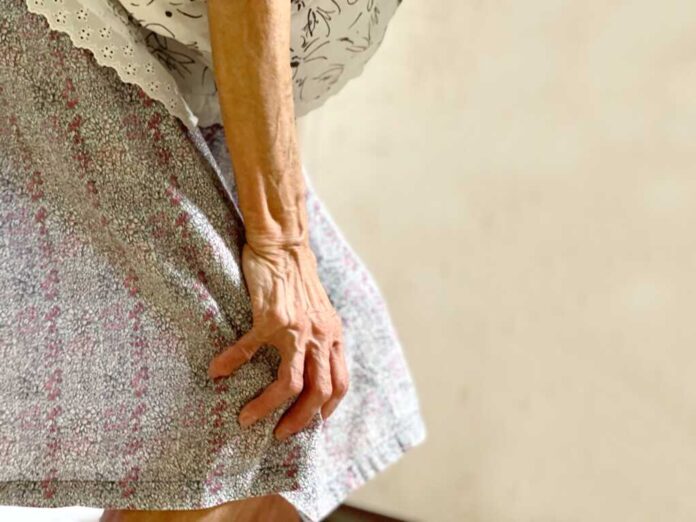 Elderly,Woman's,Hand,Holding,Her,Knee