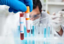 Long COVID: The Mysterious Blood Clots