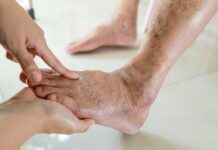 Drug-Resistant E. Coli Complicates Diabetes Care