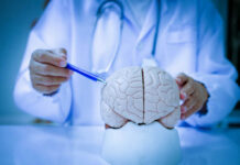 Unseen Migraine Triggers: New Findings! A doctor pointing at a brain model with a pen