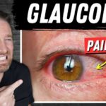 Glaucoma’s Hidden Nighttime Ambush Open Vs Closed Angle Glaucoma (Painful Glaucoma!)