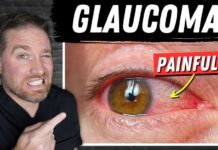 Glaucoma’s Hidden Nighttime Ambush Open Vs Closed Angle Glaucoma (Painful Glaucoma!)