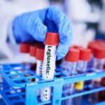 Blood Test Twist Upends Depression Playbook A gloved hand holding a test tube labeled 'Legionella' among other samples