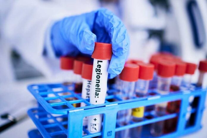 Scientist,,Hand,And,Bacteria,Sample,In,Test,Tube,,Person,In A gloved hand holding a test tube labeled 'Legionella' among other samples