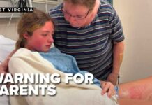Popular squishy toy sends teen to hospital with burns, what parents should know
