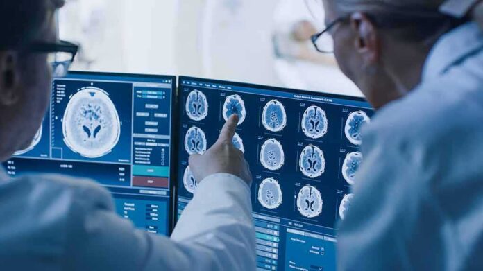 Doctors reviewing brain MRI scans on multiple monitors