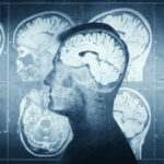 MRI scans of the brain displayed alongside a silhouette of a human head