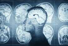 New MRI breakthrough reveals the eye and brain like never before MRI scans of the brain displayed alongside a silhouette of a human head