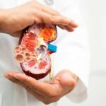 America’s Kidney Gauntlet – Half vanish Before Transplant? A healthcare professional holding a detailed model of a kidney