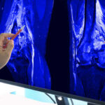 Your Bone Loss Clock Starts Earlier Than You Think A hand pointing at an MRI scan of a knee joint on a monitor