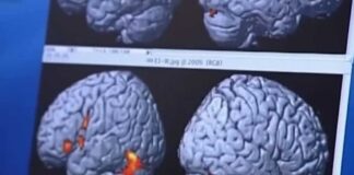 Healthy midlife habits could delay dementia by up to 13 years, study finds