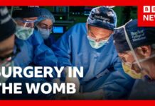 Pioneering womb surgery for 'miracle' baby with intestines outside its body | BBC News