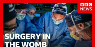 Pioneering womb surgery for 'miracle' baby with intestines outside its body | BBC News