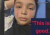 Rare Disease That Mimics Cancer Tucson boy diagnosed with rare disease