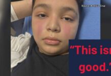 Rare Disease That Mimics Cancer Tucson boy diagnosed with rare disease