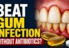 Fish Oil Rattles Antibiotic Playbook Severe Gum Disease: Fish Oil vs Antibiotics
