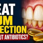 Fish Oil Rattles Antibiotic Playbook Severe Gum Disease: Fish Oil vs Antibiotics