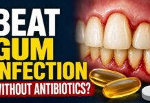 Fish Oil Rattles Antibiotic Playbook Severe Gum Disease: Fish Oil vs Antibiotics