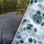 Rare ‘brain-eating amoeba’ infection leaves NC teenager critically ill Brain-eating amoeba leaves one child dead, teen in critical condition