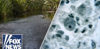 Brain-eating amoeba leaves one child dead, teen in critical condition