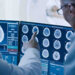 How Your Gut Could Be Aging Your Brain Faster Doctors reviewing brain MRI scans on multiple monitors