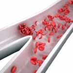 Red blood cells in a narrowed blood vessel