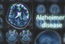 Surprise Alzheimer’s Red Flag in PCOS Women Brain MRI scans with highlighted section and text overlay