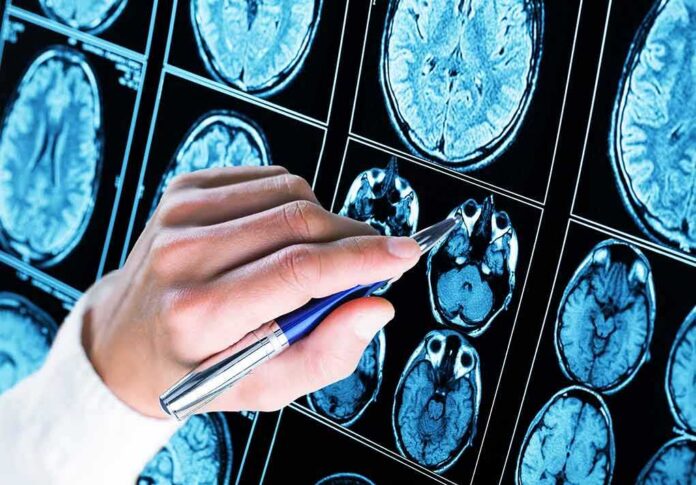 Hand with pen pointing at brain MRI scans