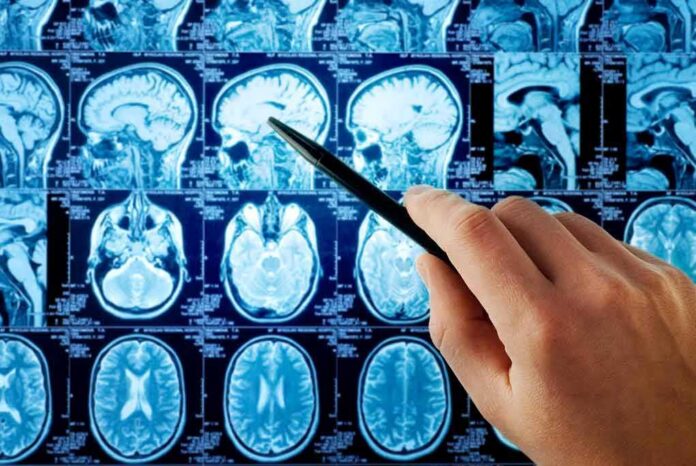 shutterstock_118491940 Hand pointing at brain MRI scans with a pen